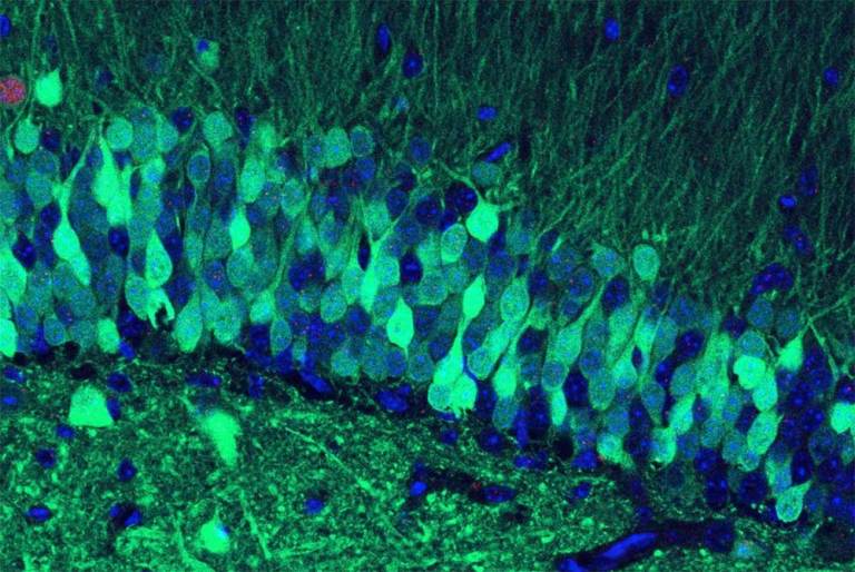 Fluorescence photomicrograph illustrating cells involved in forming a memory circuit (engram).