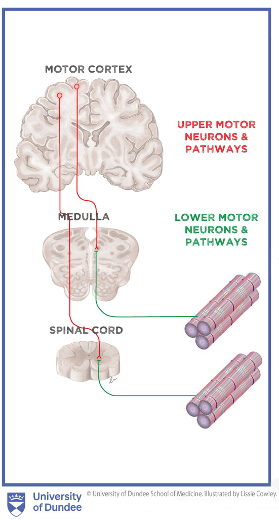 Diagram showing the path taken by upper vs lower motor neurons