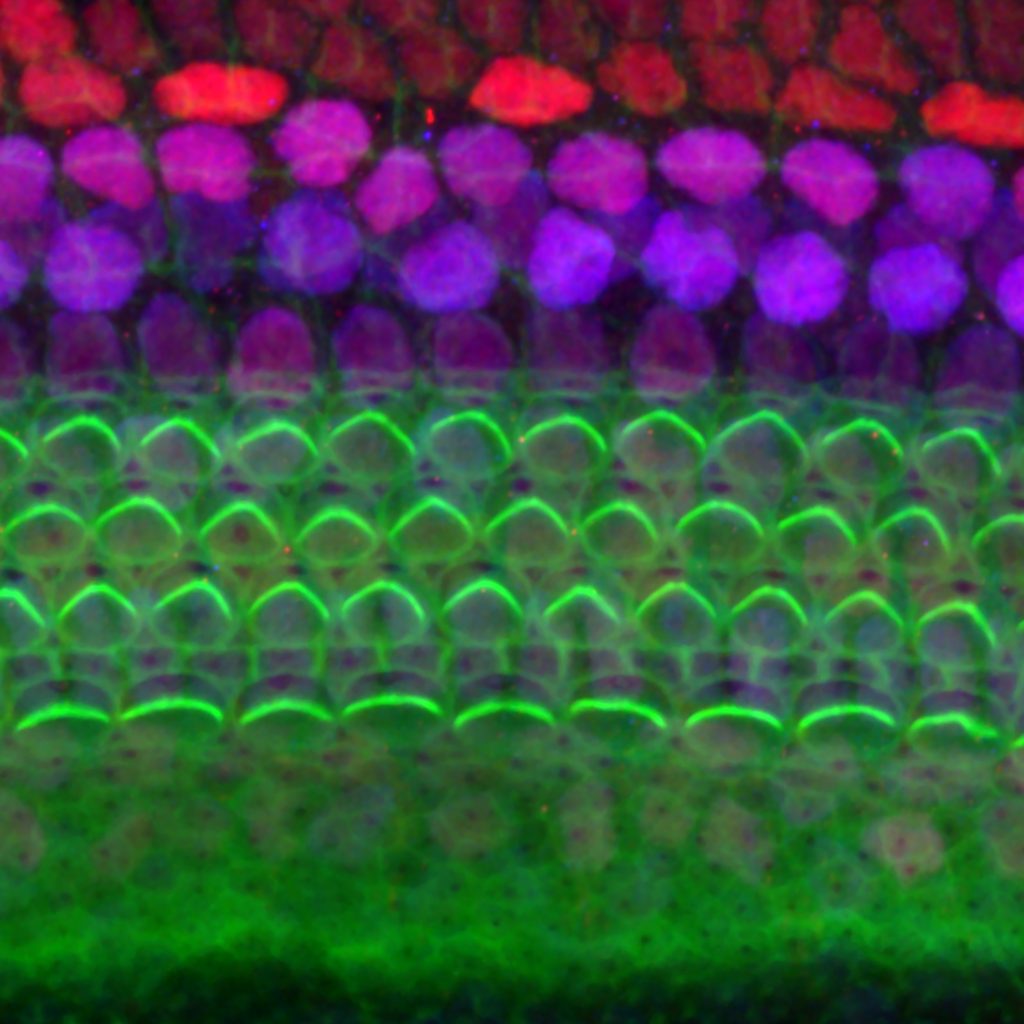 Photomicrograph of the hair cells of the inner ear.