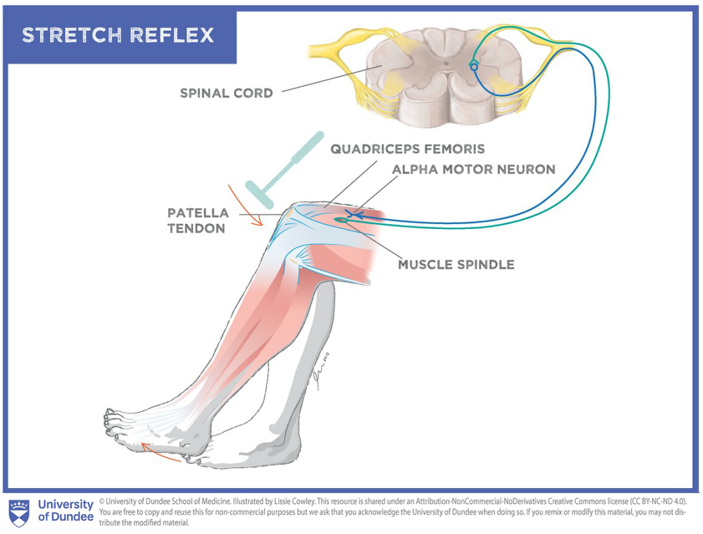 Diagram outlining the elements of the stretch reflex.