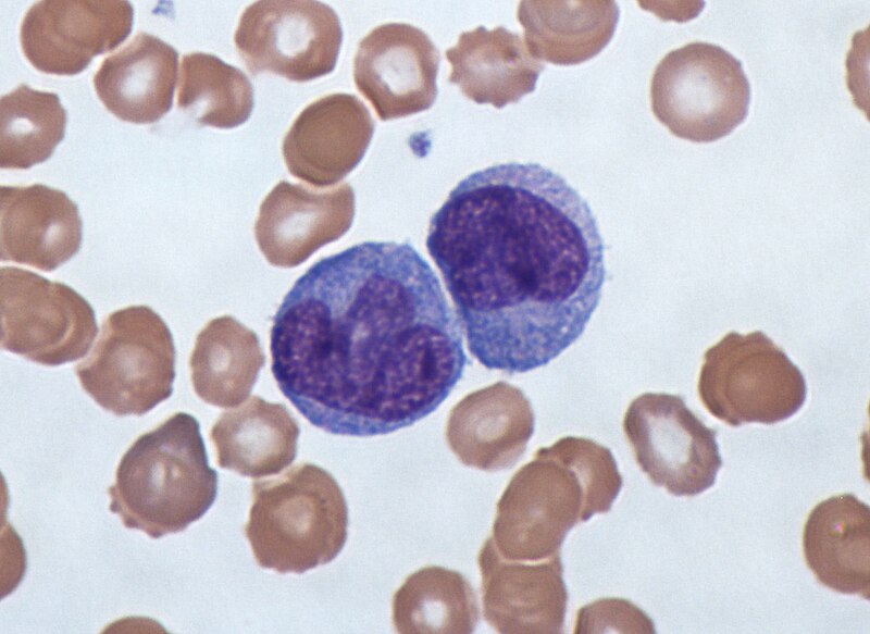 Photomicrograph of two monocytes.