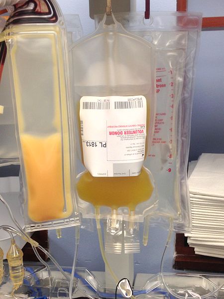 Photograph of a bag of plasma at a blood center.