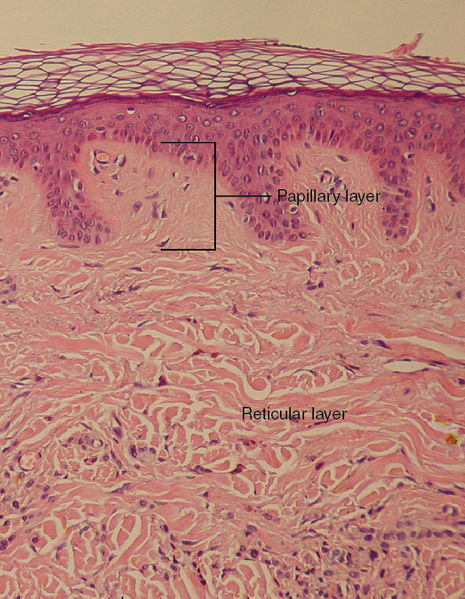 Graphic showing the histological view of the layers of the dermis.
