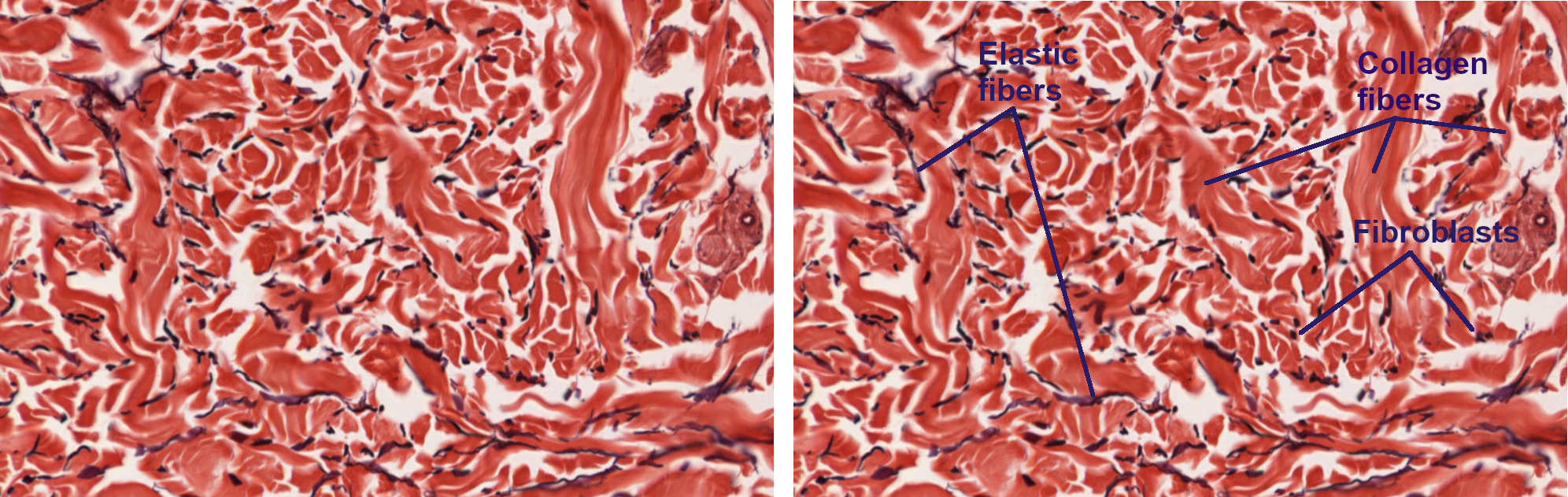 Image of dense irregular connective tissue