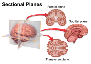 Graphic showing the sectional planes of the human brain