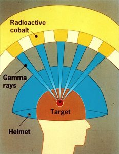 Depiction of a gamma knife.