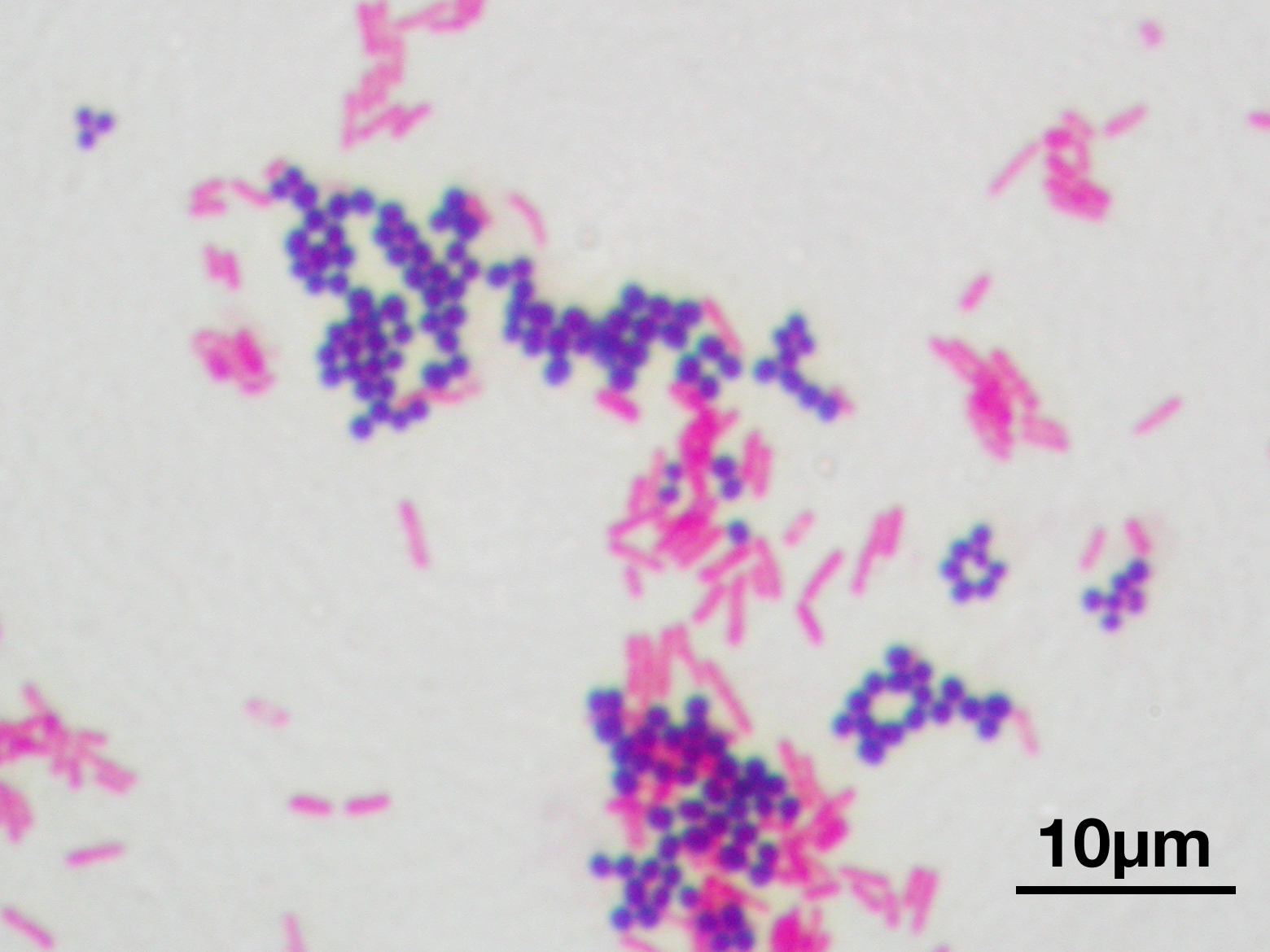 Image of gram stain