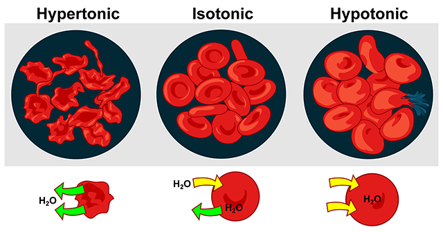 Diagram of cellular changes within hypertonic, isotonic, and hypotonic soultions