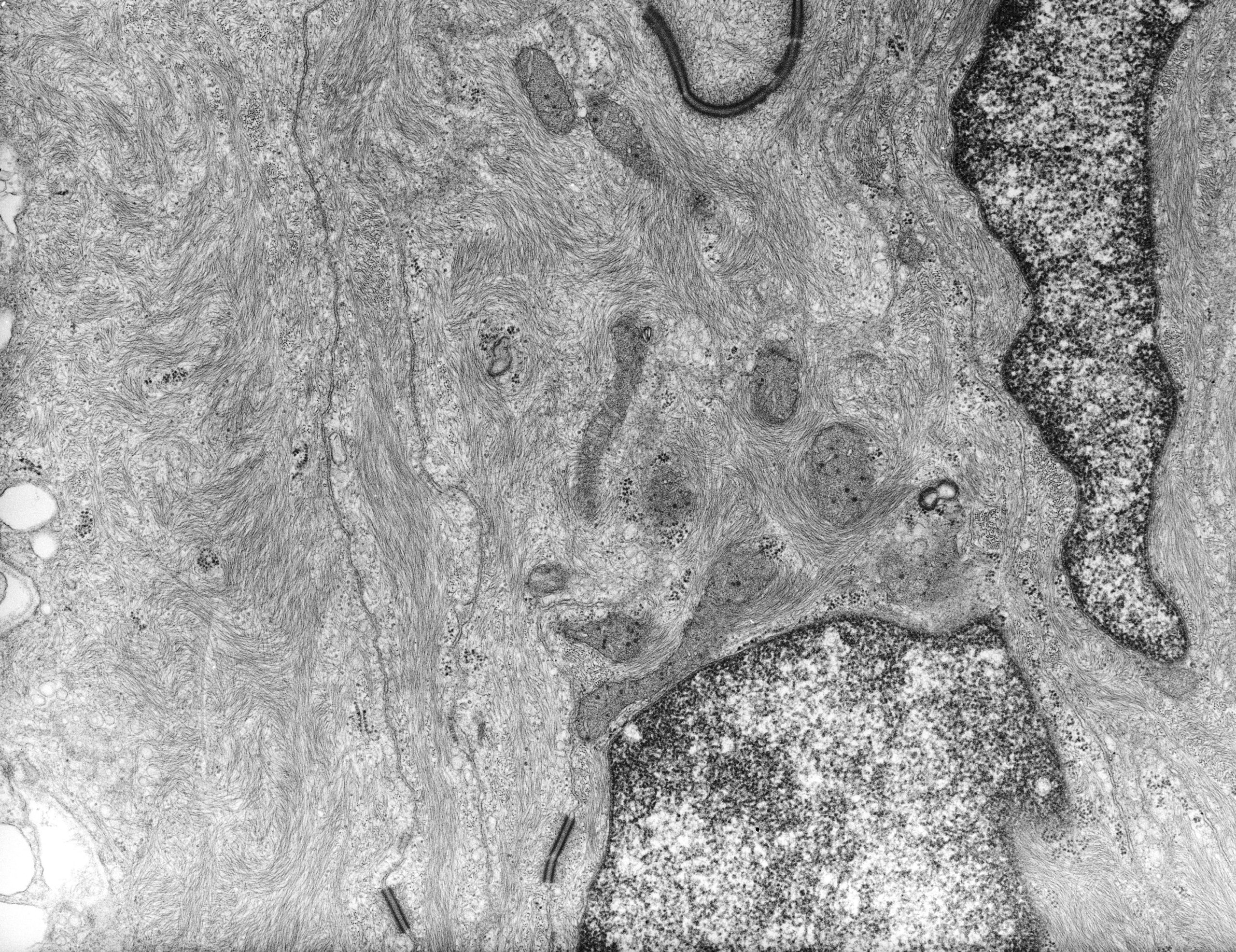 This group of micrographs illustrate the ultrastructural characteristics of the middle layer of the three meningeal layers that cover the central nervous system The arachnoid cells contain abundant intermediate filaments that occupy a substantial volume of the cytoplasm. In some cells the intermediate filaments are organized into numerous coils of relatively uniform size and lie parallel to the outer surface of the central nervous system, such that sections cut tangential to the membrane surface (see CIL:9301) show the spirals but transverse sections such as this one do not. The plasma membrane of these cells has many caveolae. Adjacent arachnoid cells are connected by large desmosomes. Images were recorded using a Philips EM301 TEM at 80 kv. Original glass plates were scanned and digitized using an Epson V750 flatbed scanner with a step size of 15 micrometers.
