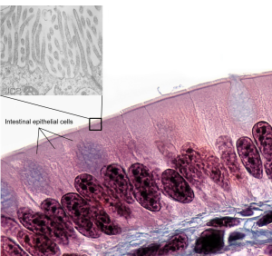 This is an image of microvilli in intestinal epithelium