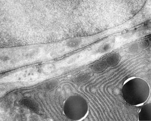 An image of smooth endoplasmic reticulum