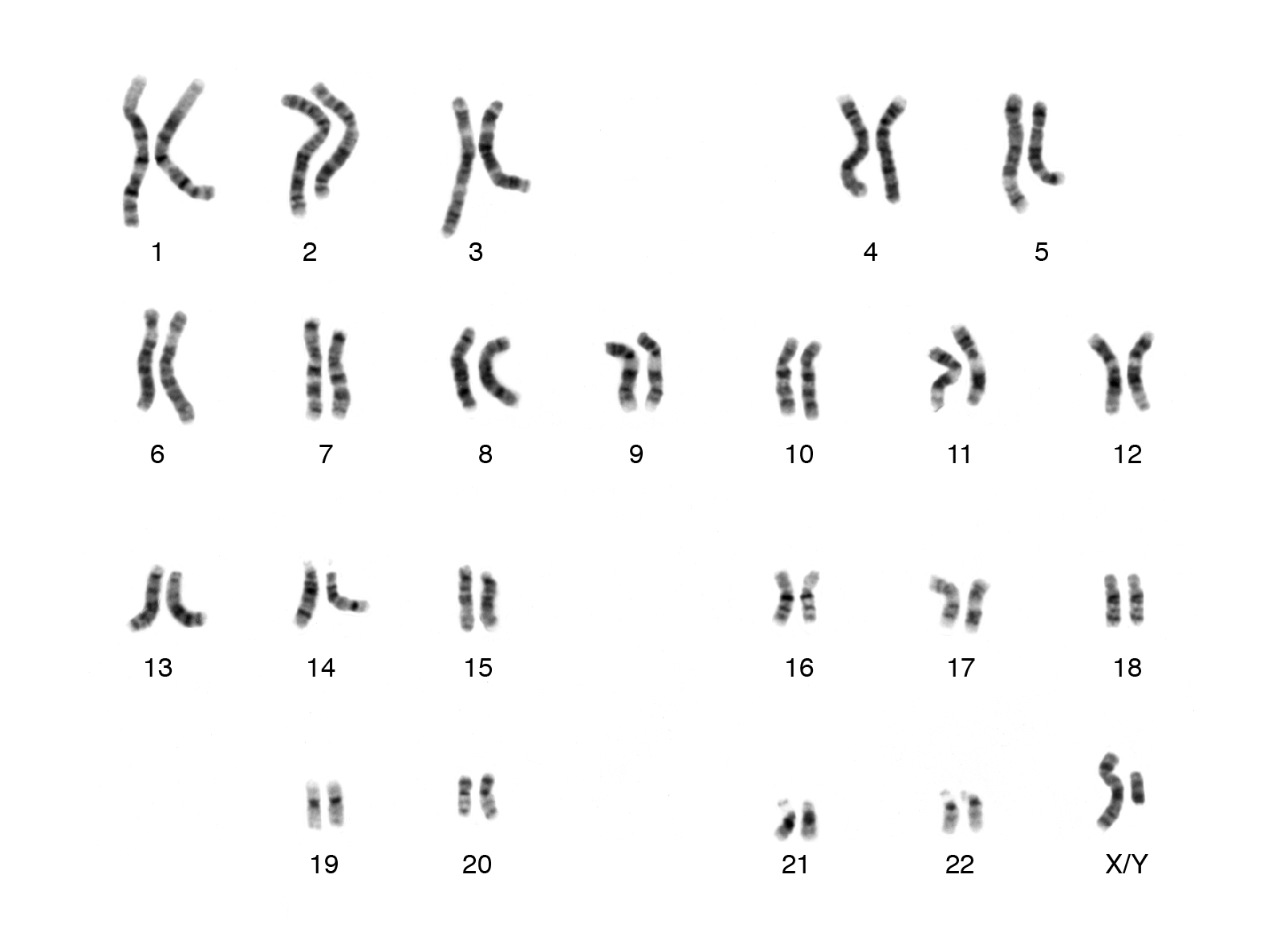 Graphic showing a karyotype, with chromosomes lined up by size.