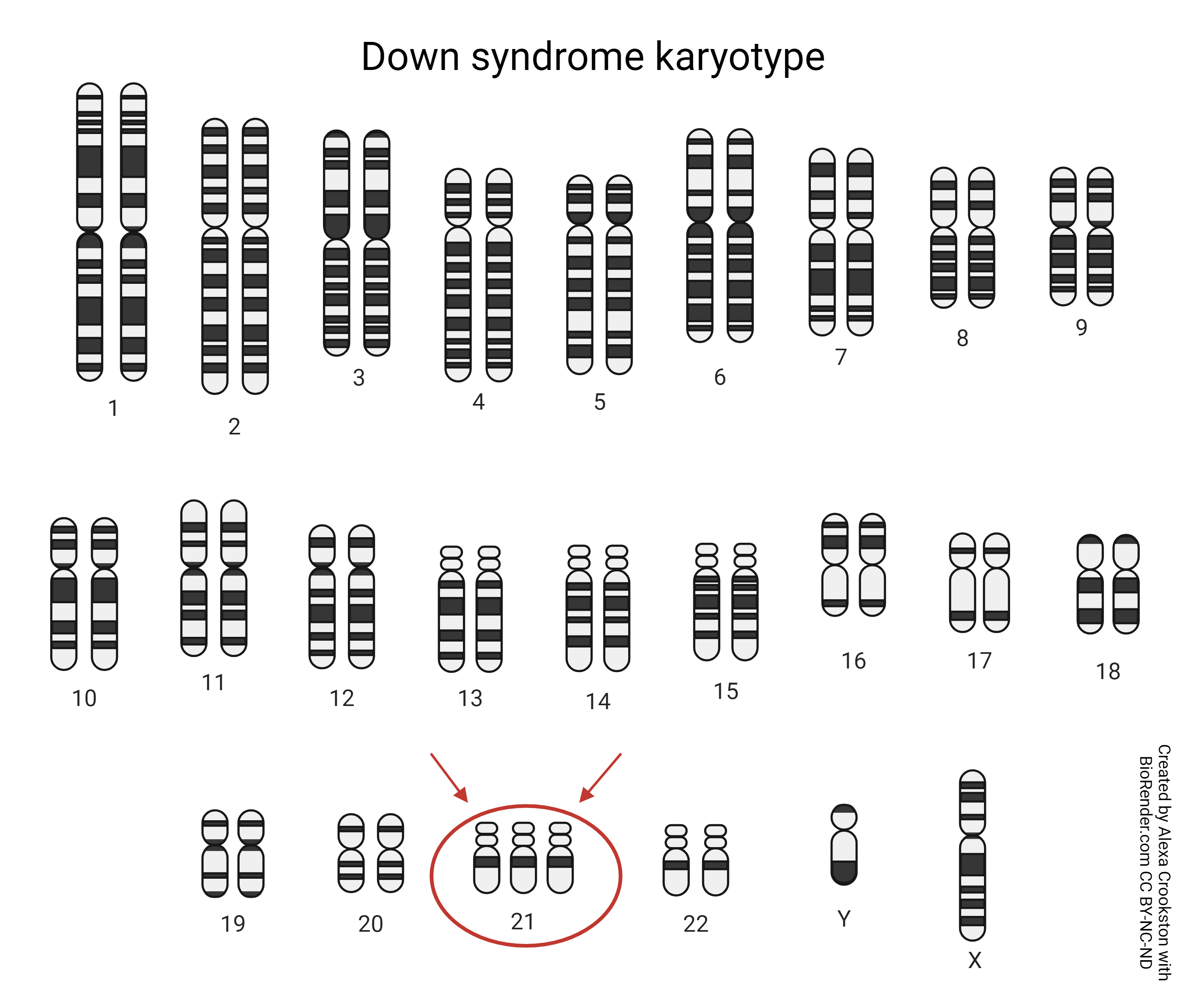Graphic showing the karyotype of Down Syndrome