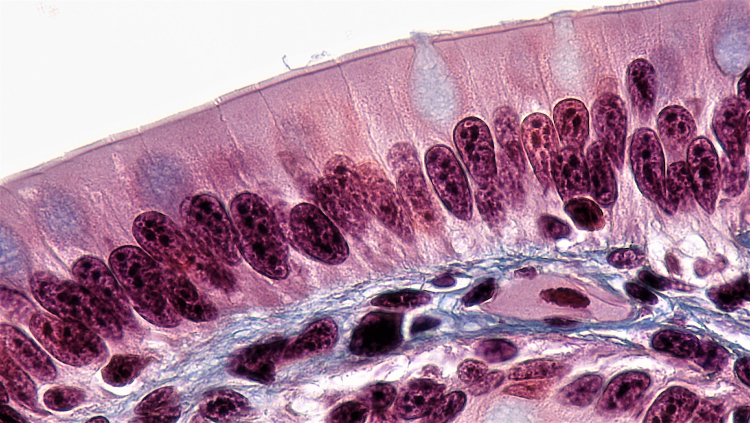 Image of simple columnar cells