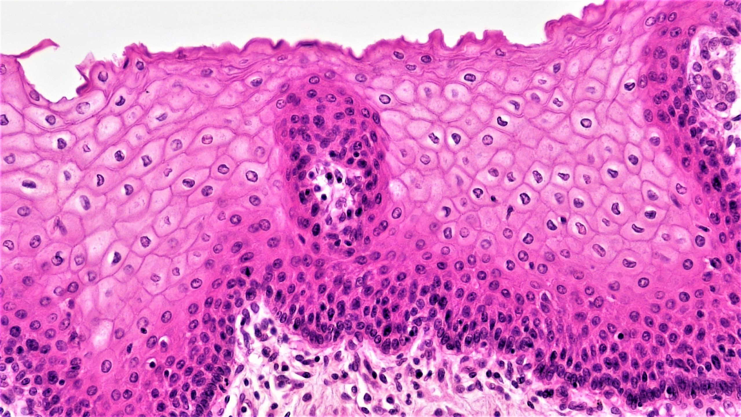 Image of stratified squamous cells