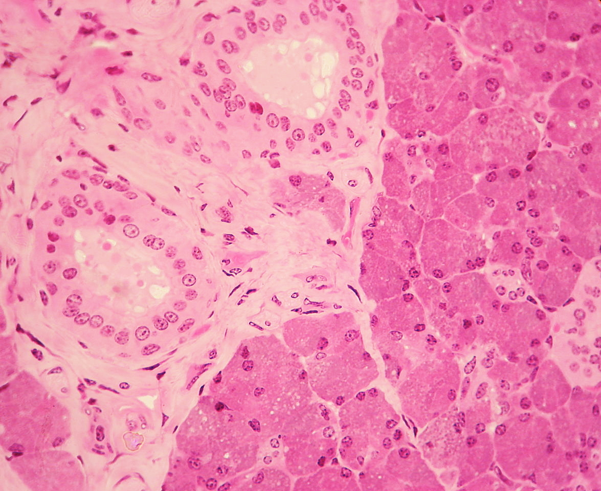 Image of stratified columnar cells