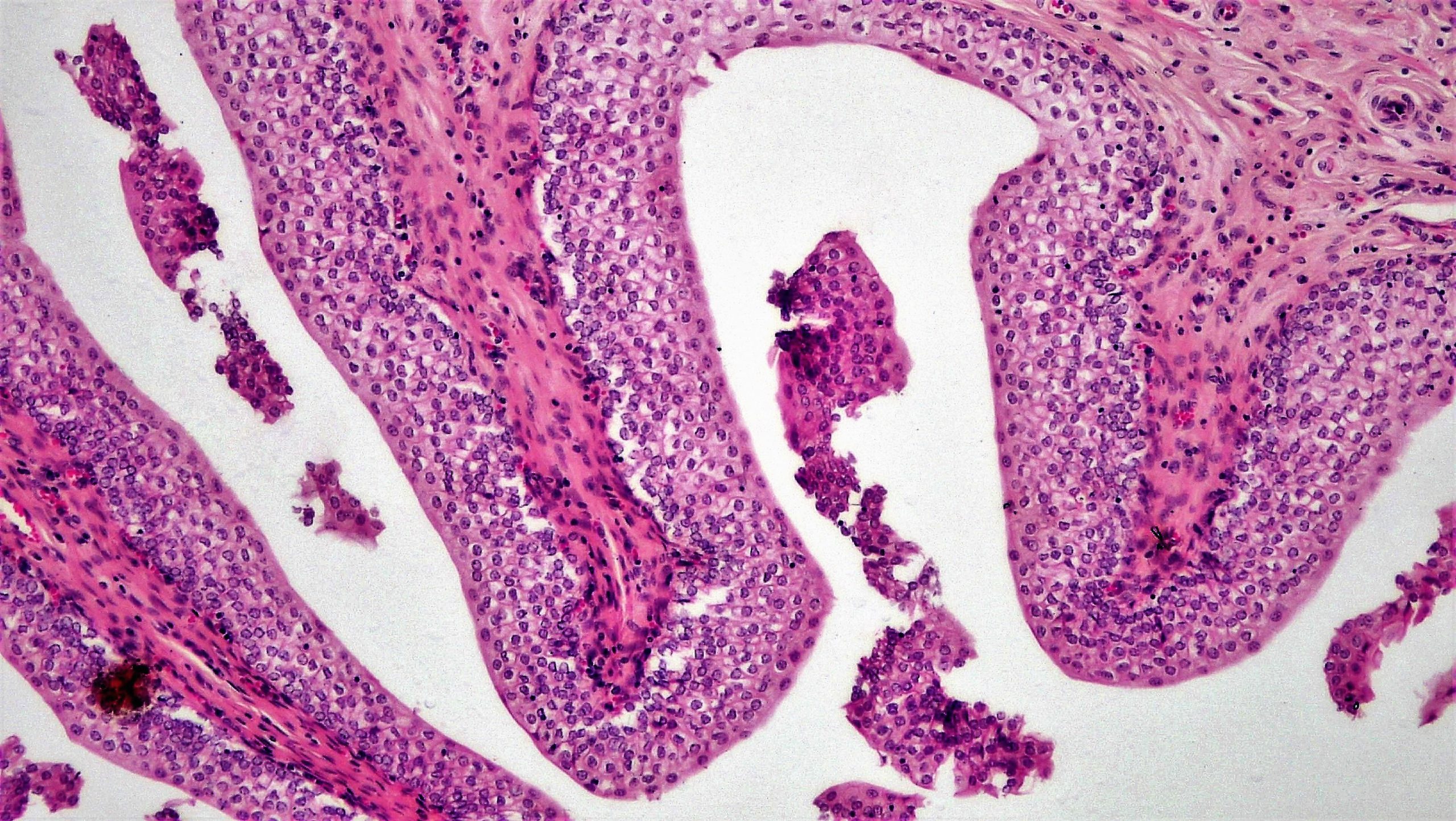Image of transitional epithelium