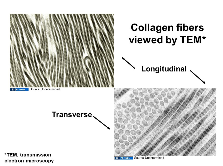 Images of collagen fibers