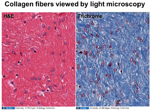 Image of collagen fibers