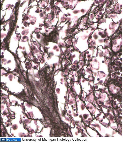 Image of reticular fibers