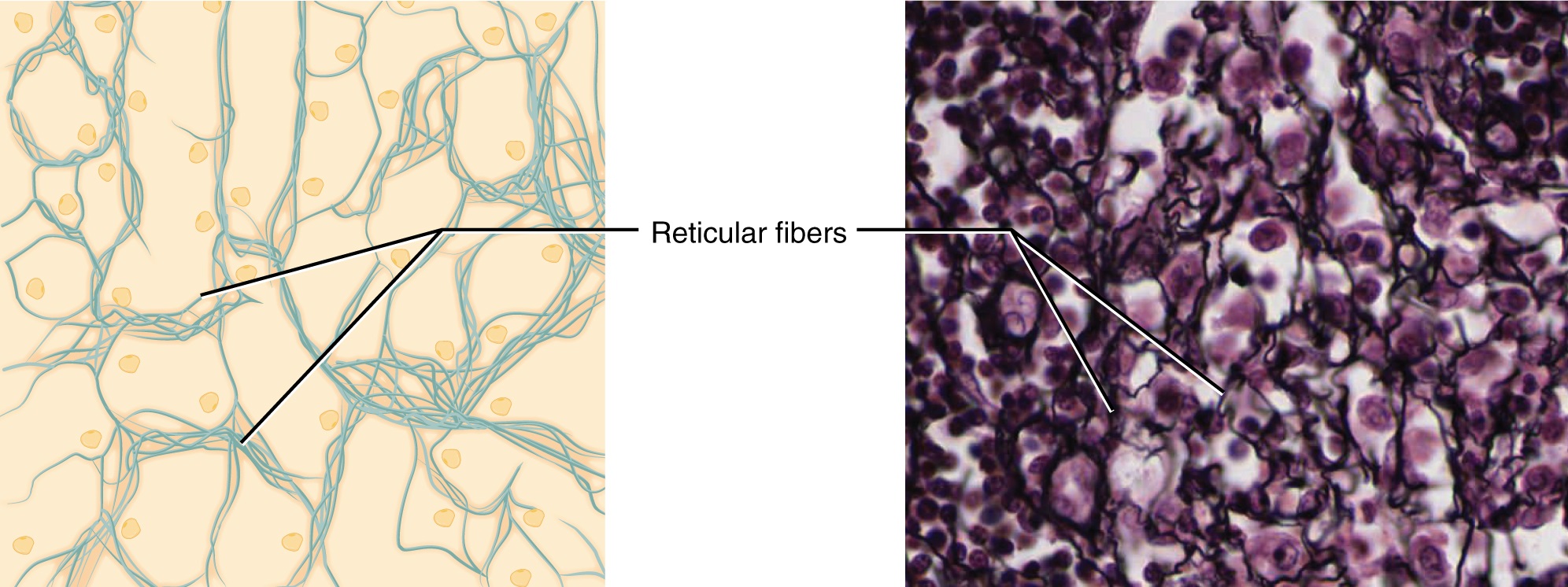 Diagram and image of reticular connective tissue