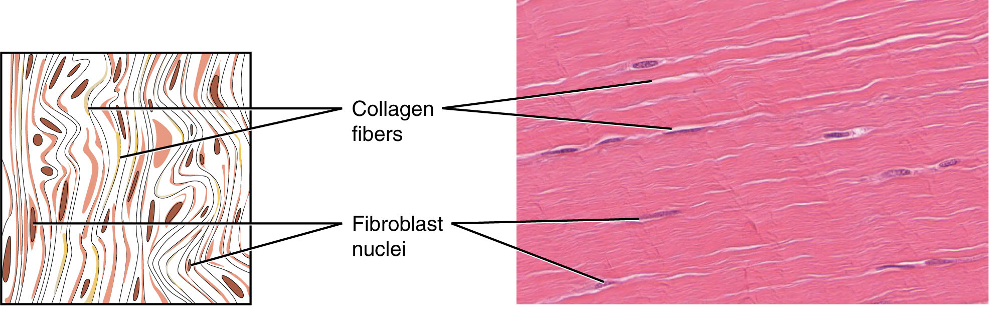 Diagram and image of dense regular connective tissue