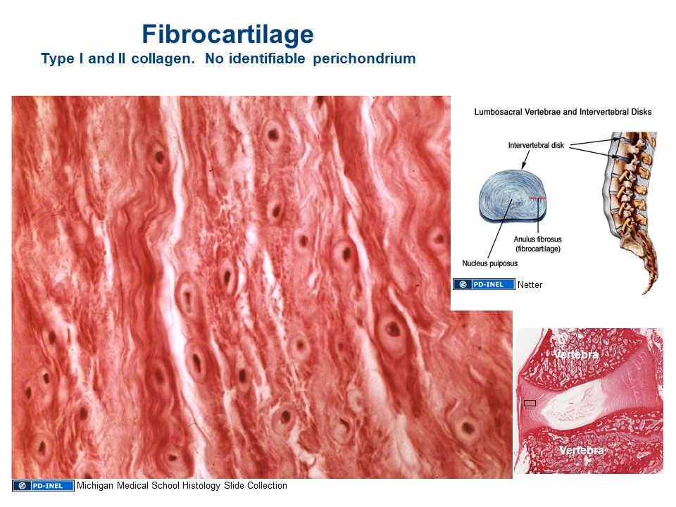 Diagram and image of fibrocartilage