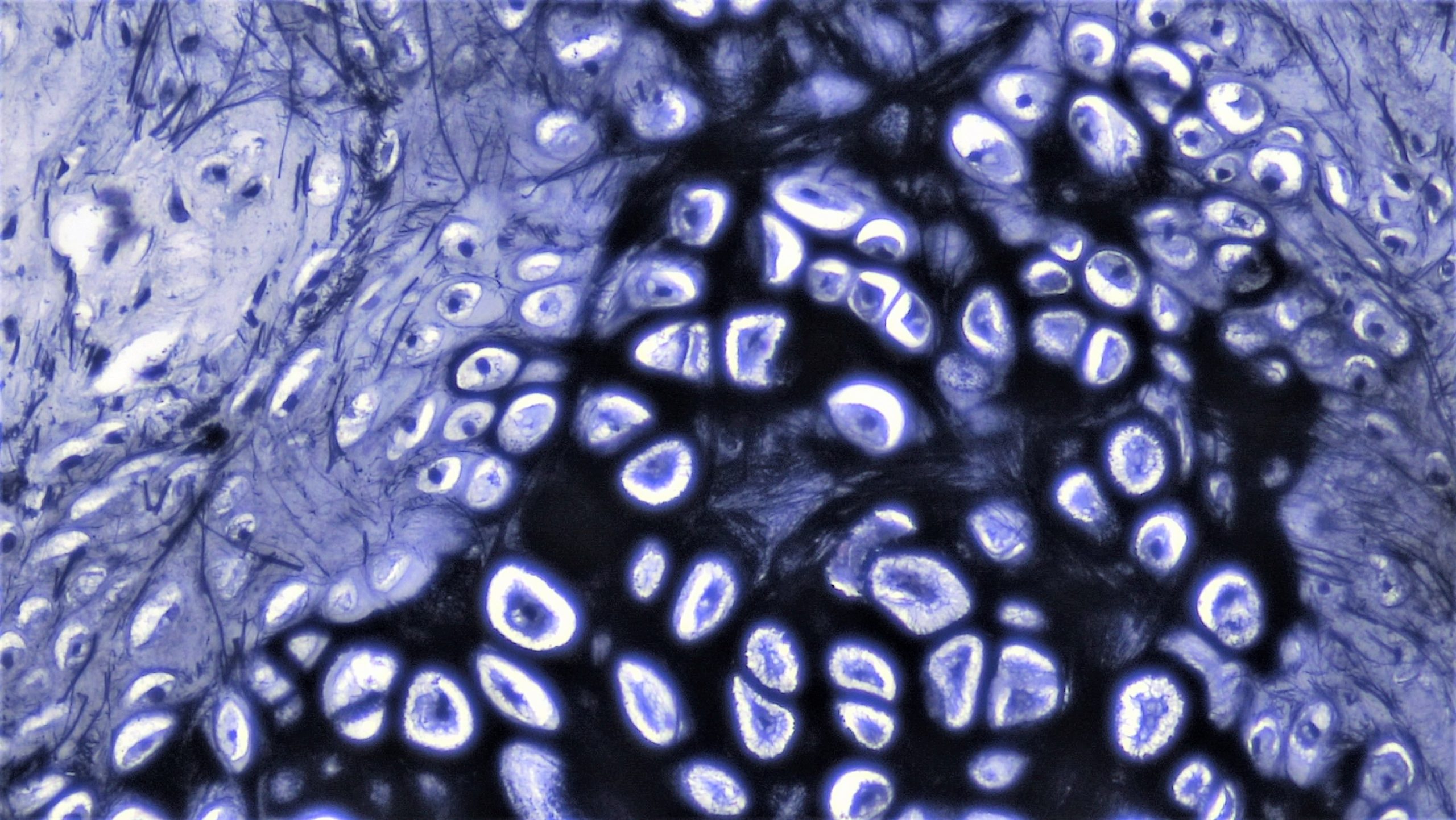 Image of elastic cartilage