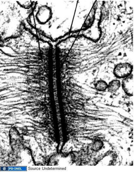 Image of desmosome