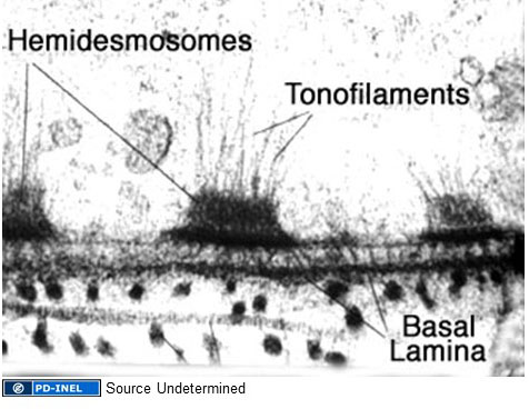 Image of hemidesmosomes
