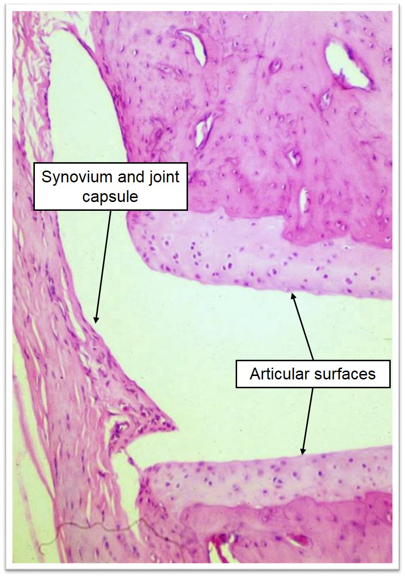 Image of synovial joint histology including joint capsule and articular surfaces
