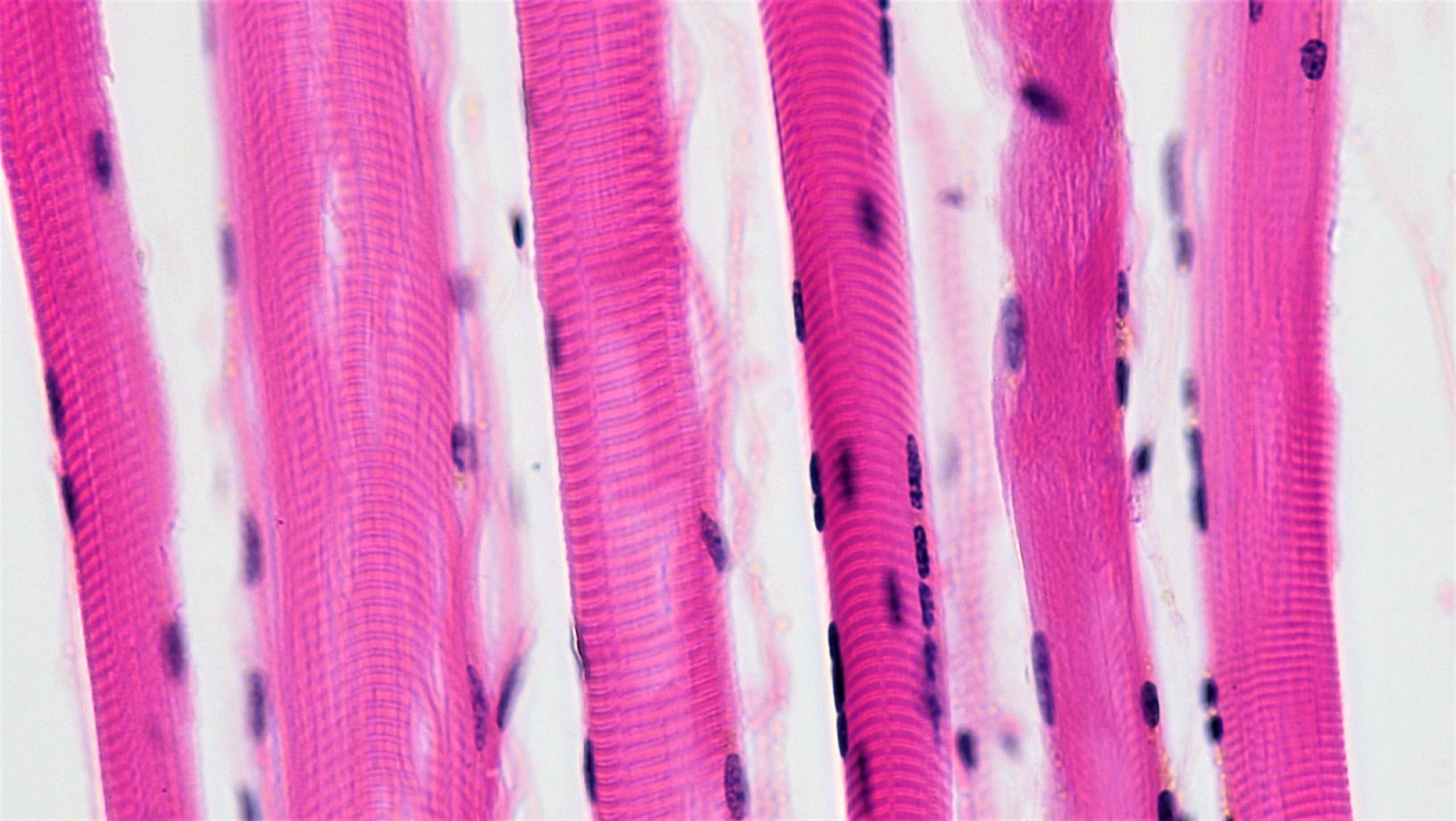 Image of skeletal muscle