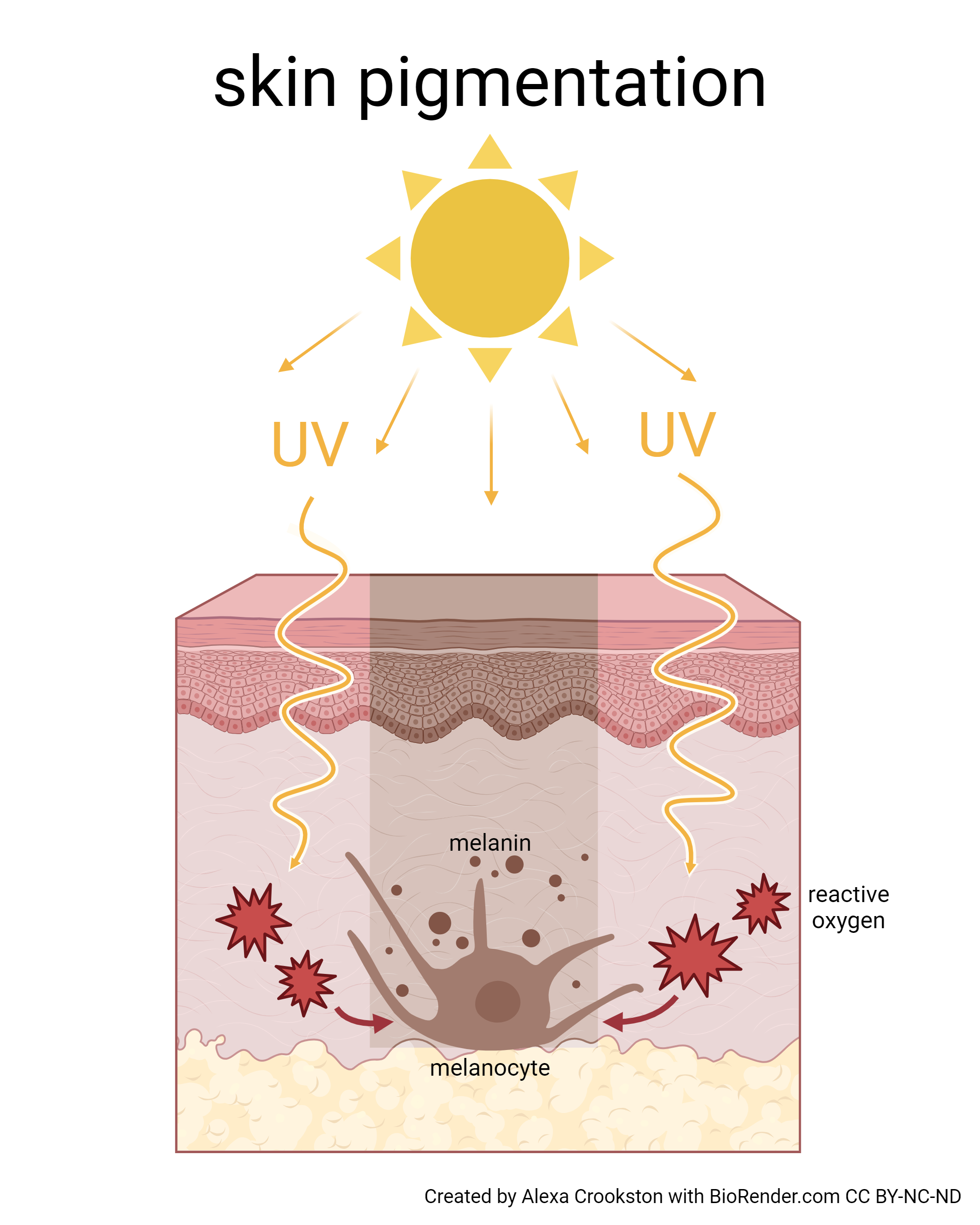 Graphic showing UV causing skin pigmentation.