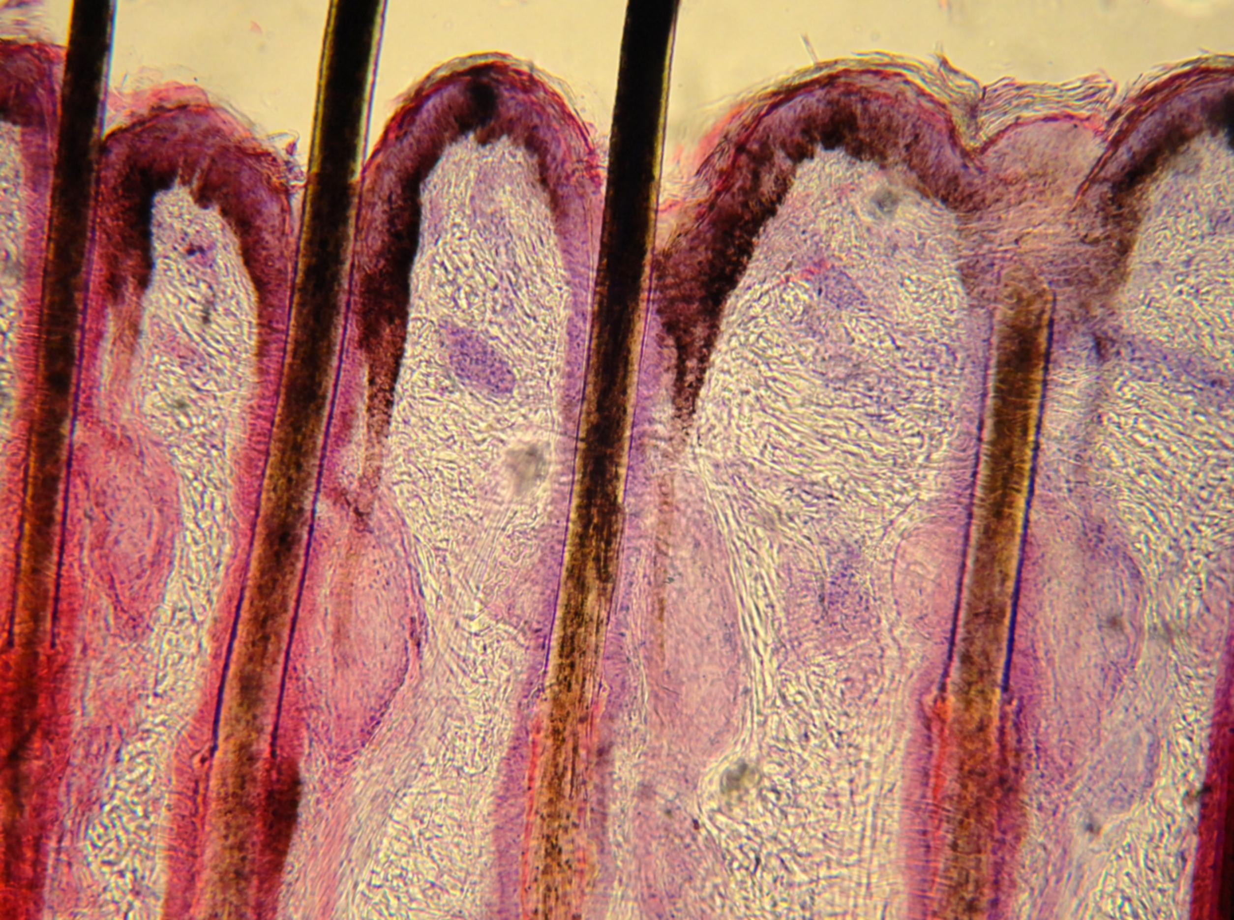 Graphic showing a histologic view of hair.