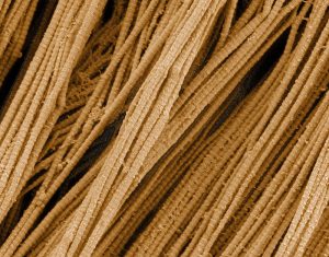 Microscope images of collagen fibers.
