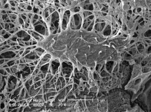 A picture showing a mouse osteocyte with the associated canaliculi.