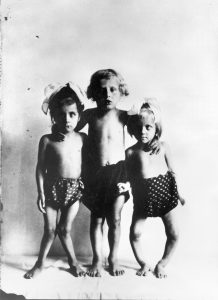 A photograph of children with rickets.