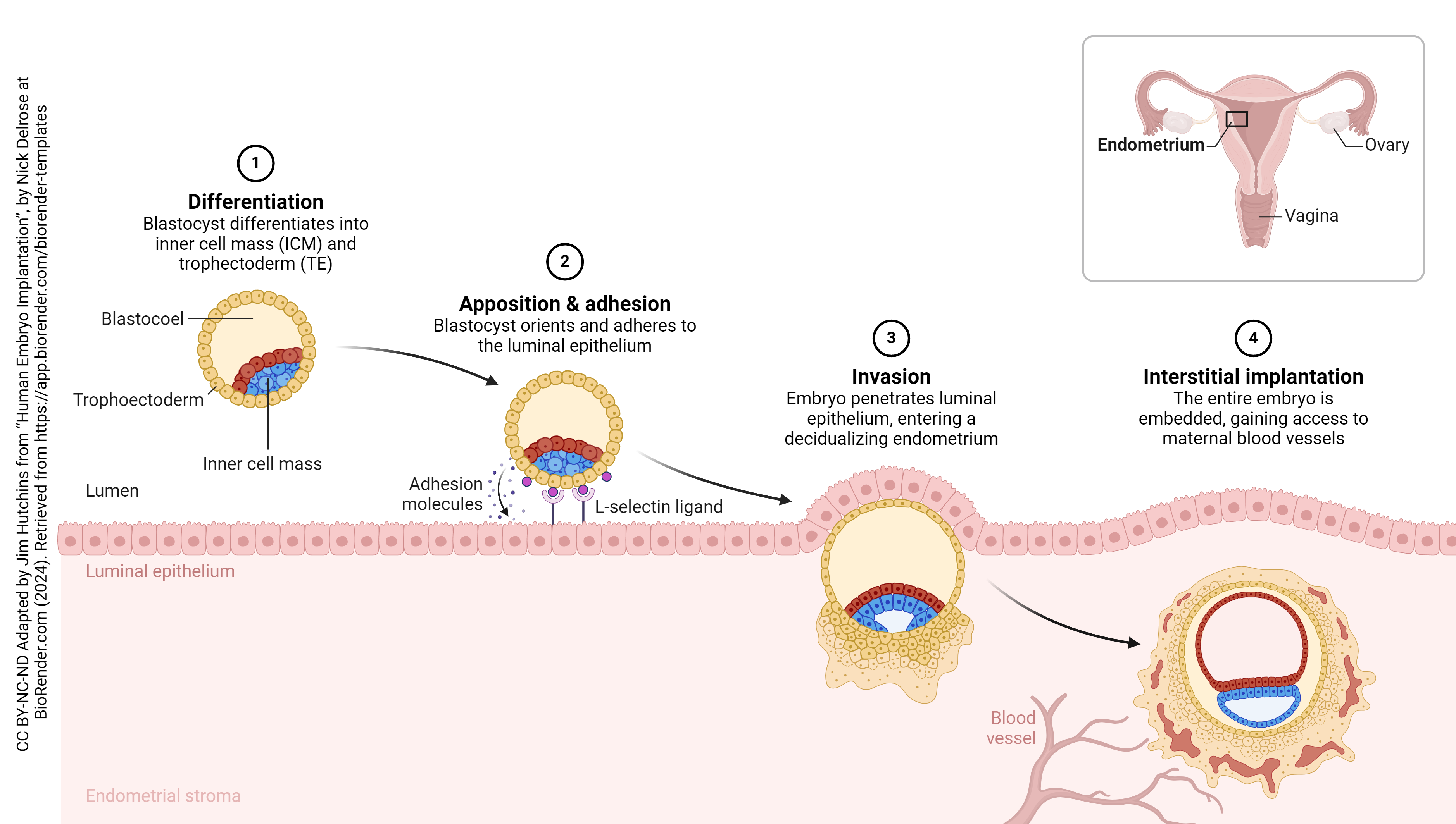 Diagram showing implantation of a human embryo.