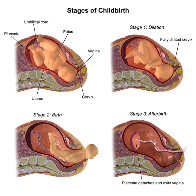 Illustration of the stages of labor.