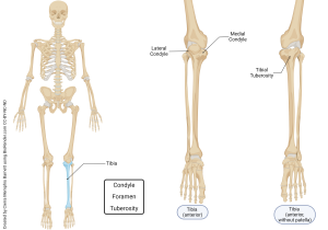 An image examples of bone markings: condyle and tuberosity.