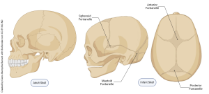 A image showing a comparison of the adult and infant skulls.