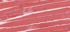 A histological representation of skeletal muscle cells.