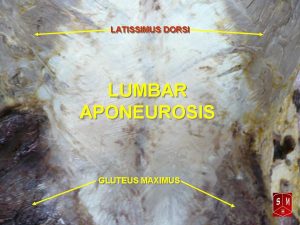 A photograph of the lumbar aponeurosis with muscle labeled.