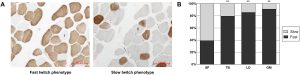 Images showing fast twitch and slow twitch muscle fibers.