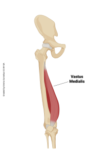 An illustration showing the origin and insertion of the vastus medialis muscle.