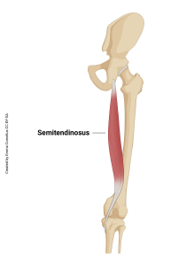 An illustration showing the origin and insertion of the semitendinosus muscle.