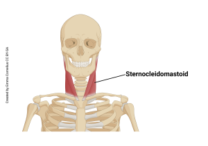 An illustration showing the origin and insertion of the sternocleidomastoid muscle.