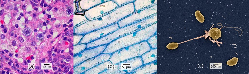 Part a: Human cheek cells as viewed by light microscopy have an irregular round shape and a well-defined nucleus that takes up about one-half of the cell. Part b: Onion skin cells, also viewed by light microscopy, are long and thin with a rectangular shape defined by a cell wall. They are about as wide as a cheek cell, but at least five times as long. The cell wall and nucleus are well defined in the micrograph. The onion cell nucleus is about the same size as the cheek cell nucleus. Part c: In this scanning electron micrograph of bacterial cells, the cell surface has a three-dimensional shape. Three of the bacteria are oval in shape. The fourth is round and has protrusions called pili. One pilus connects this bacterium to another.