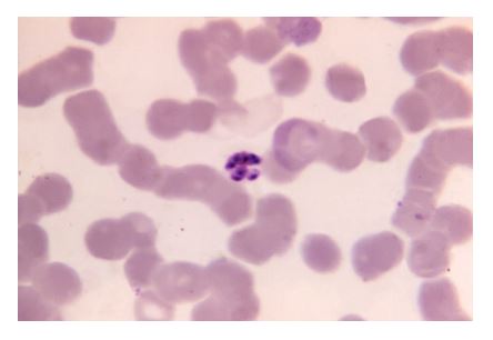 Plasmodium falciparum, here visualized using false-color transmission electron microscopy