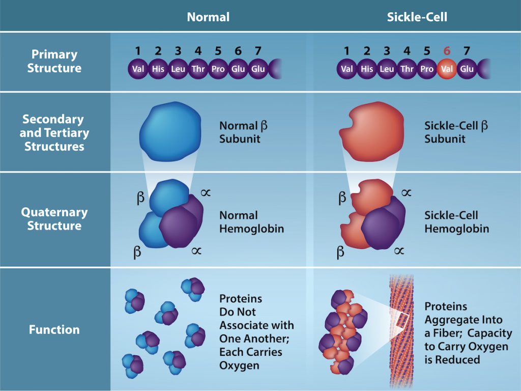 Several representations of hemoglobin proteins are shown under normal and sickle cell conditions. In primary structure, the sixth amino acid is replaced by valine. In secondary and tertiary structures, the sickle cell is revealed by a misshapen molecule. As a result, in function, normal hemoglobins do not associate with each other, and each can carry oxygen. But in sickle cell conditions, the proteins aggregate into a fiber and oxygen carrying capacity is reduced.